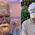 Argyria, disease that turns you into a smurf