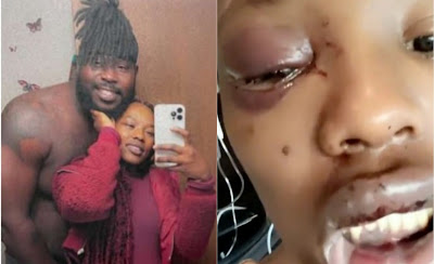 “He Is My Soulmate”— Lady Says, 56 Days After Fiance Beat Her To Stupor (Video)