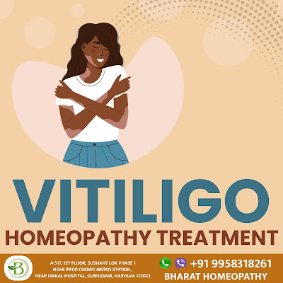 Vitiligo Treatment By Homeopathy