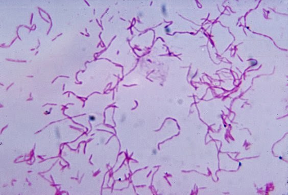 http://www.lookfordiagnosis.com/mesh_info.php?term=fusobacterium+necrophorum&lang=1