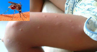 This Trick Is The Best , Get Rid Of Mosquitoes Forever
