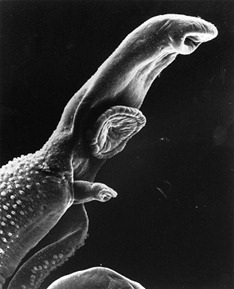 schistosome