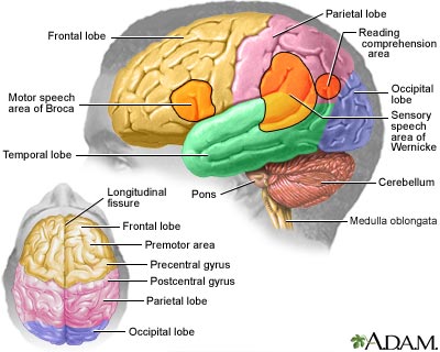 A brain dysfunction related