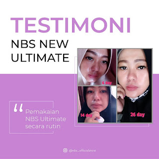 Testimoni NBS Skin Care Stockist Makassar