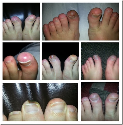 Toes