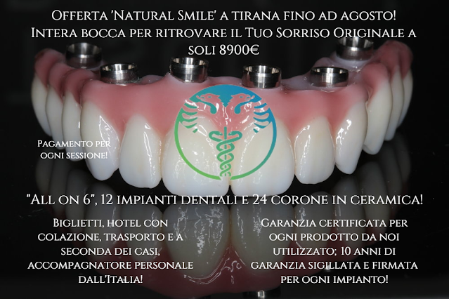 Il legame tra artrite psoriasica e salute dentale