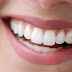 Tẩy trắng răng như thế nào là an toàn?