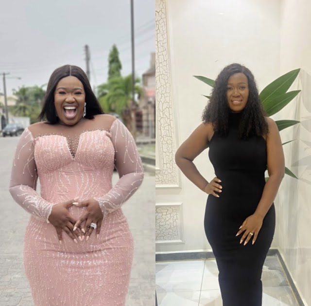 What I Regret About My Weight Loss Surgery - Warri Pikin.