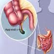 Diagnose of Appendicitis