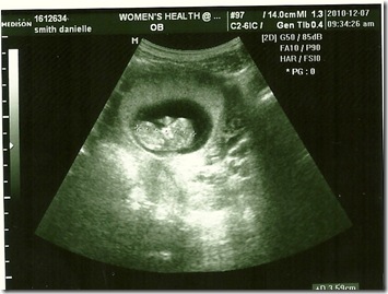 baby 2