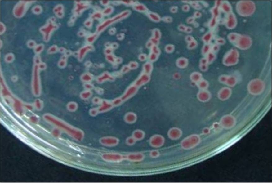 Catatan harian Teknik Identifikasi Bakteri