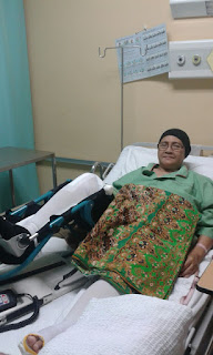 Pembedahan Lutut Dengan Memasukkan Besi Pada Lutut Disebabkan Osteoarthritis