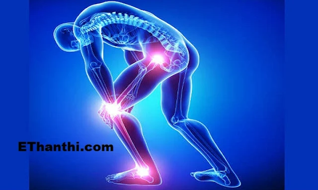 எலும்பு மெலிவு நோய் - Osteomalacia