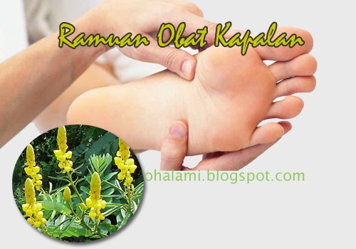 Ramuan Obat Alami Untuk Mengobati Kapalan