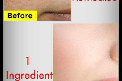 It Only Takes 1 Ingredient To Remove Pores On Your Face At Home
