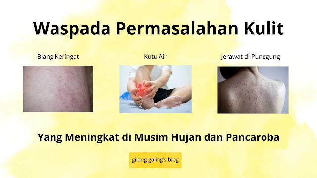 waspada inspeksi kulit di musim hujan seperti kutu air dan biang keringat