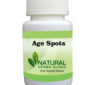 Herbal Product for Age Spots