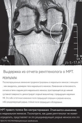 МРТ или магнитно-резонансная томография — это наука о быстро развивающихся технологиях.