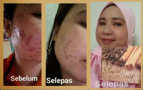 Pewiit Soap & Pewiit Skincare Murah