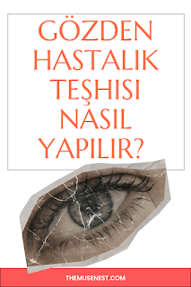 İridolog Uzmanı – Gözden Hastalık Teşhisi Nedir, Nasıl Yapılır?