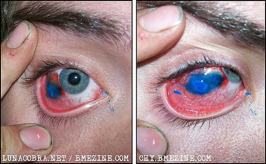 Eyeball Tattoos Banned in Midwest State!