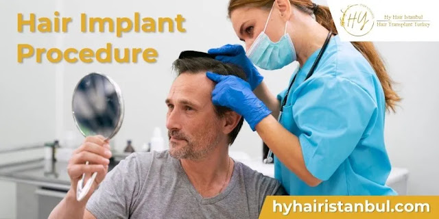 Hair Implant Procedure