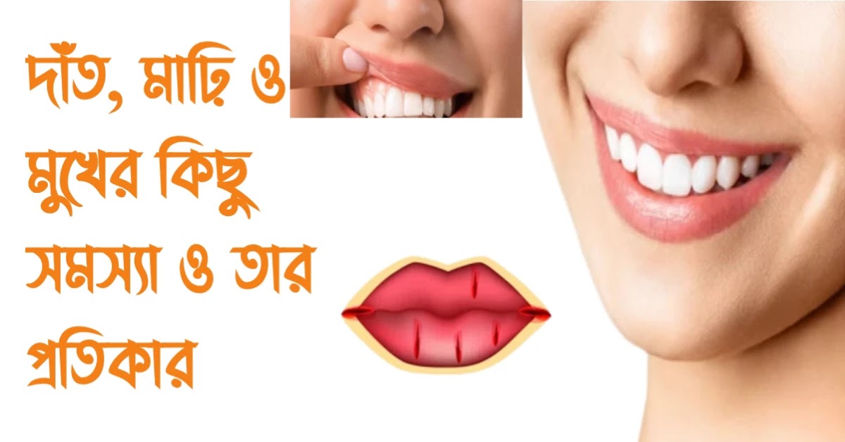 দাঁত, মাঢ়ি ও মুখের কিছু সমস্যা ও তার প্রতিকার