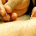 The New Needleless Acupuncture in Bangladesh