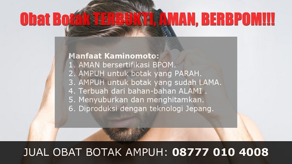 jual OBAT PENUMBUH RAMBUT BOTAK Suka Makmue<br/>