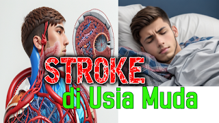 stroke di usia muda