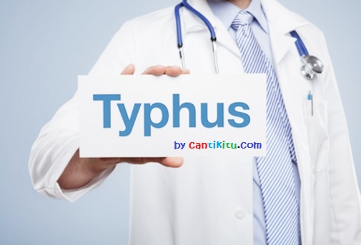  tipes atau demam tifoid terjadi lantaran benjol basil  9+ Gejala Tipes Pada Anak dan Orang Dewasa Menurut Dokter