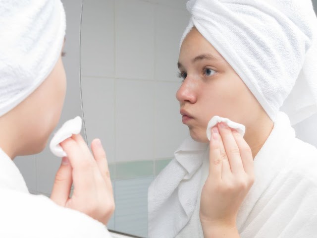 Everything You Need to Know About Acne Wipes