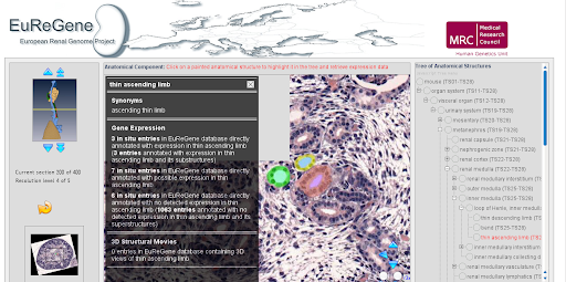 Página Web del Atlas Renal Online de EuReGene, un atlas interactivo del riñón centrado en la información genética