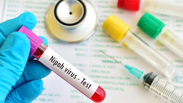 Emerging Threat-Nipah Virus Resurgence