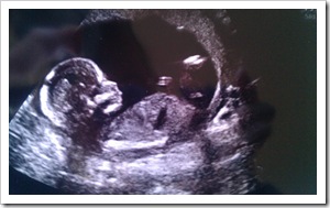 16 weeks