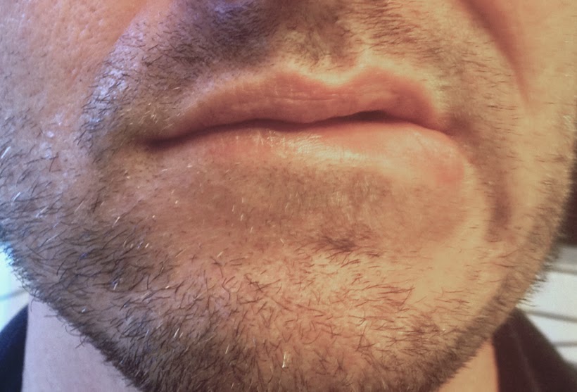 gay stubble