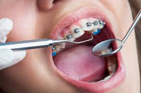 expert orthodontics services Richmond