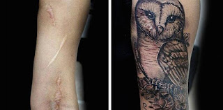 tatuaje cicatriz brazo