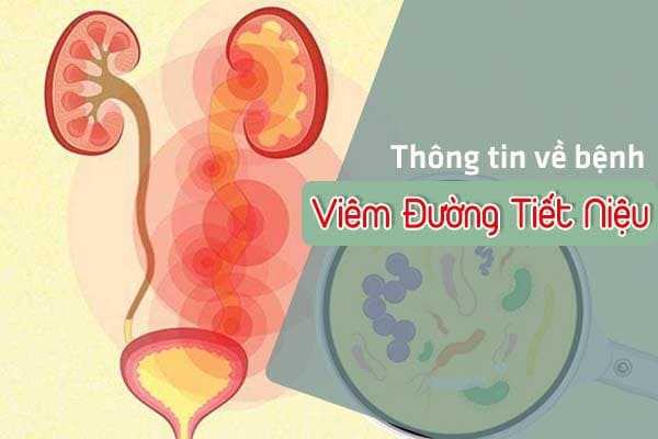 Tìm hiểu bệnh viêm đường tiết niệu