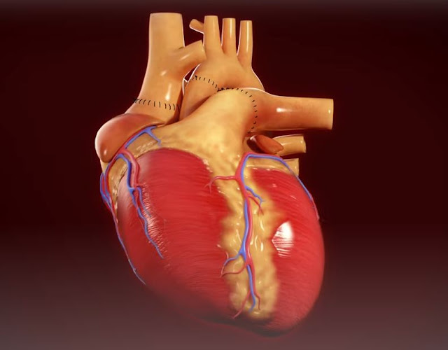 جراحة زراعة القلب