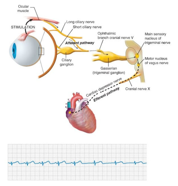 Dagnini’s reflex ( Aschner-Dagnini test, Oculocardiac Reflex )