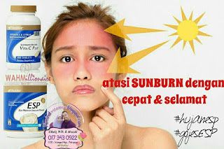 vitamin shaklee untuk sunburn