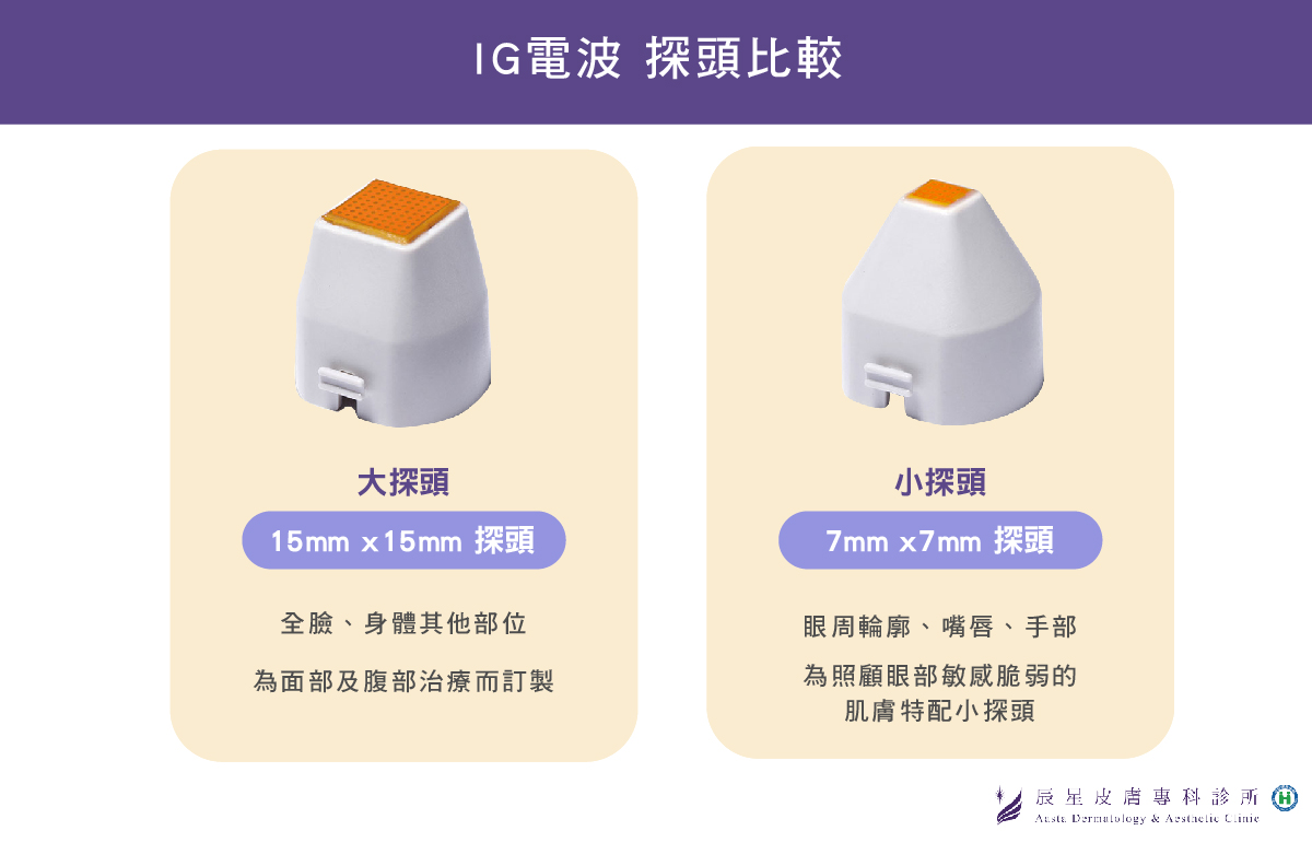 IG電波兩種探頭比較