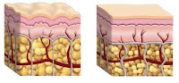 Las toxinas , la grasa y el líquido se acumulan en ciertas partes del cuerpo y forma la celulitis . Muslo es un área importante para las mujeres donde la grasa se ​​acumula fácilmente. Para deshacerse de la celulitis, usted tiene que concentrarse en la pérdida de grasa.