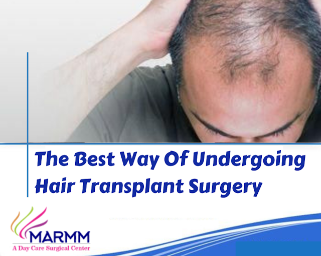 Hair Transplant in Indore, Hair Transplant Cost in Indore
