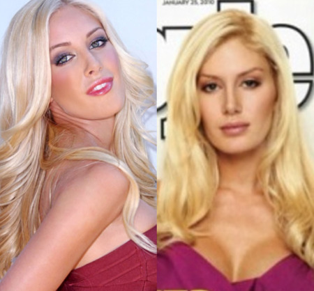 heidi montag before and after plastic surgery. heidi montag before and after