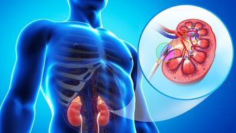  kidneys tone remedy