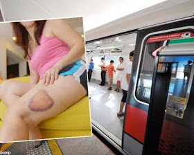 Woman suffers palm-sized bruise after her leg gets caught in MRT platform gap 