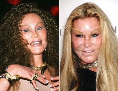 jocelyn wildenstein 2010. is Jocelyn Wildenstein?