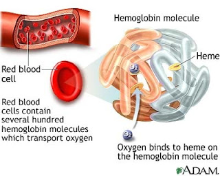 Anemia Karena Kekurangan Zat Besi